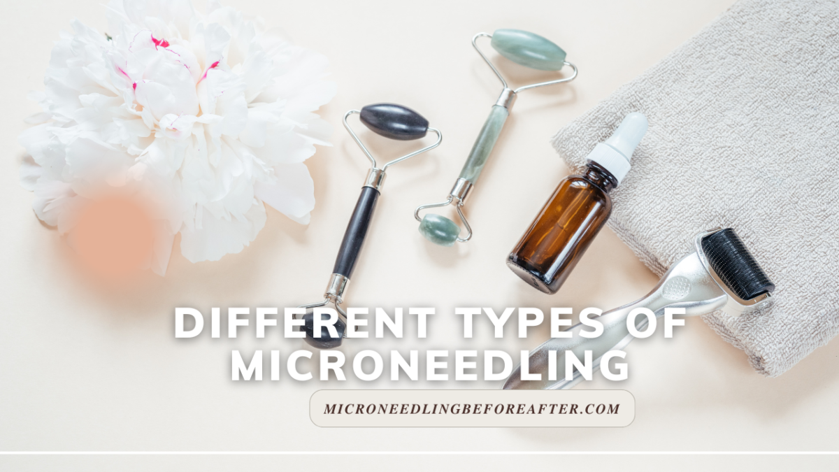 Different Types Of Microneedling