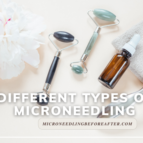 Different Types Of Microneedling