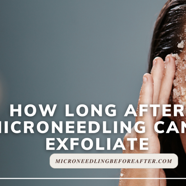 How Long After Microneedling Can I Exfoliate