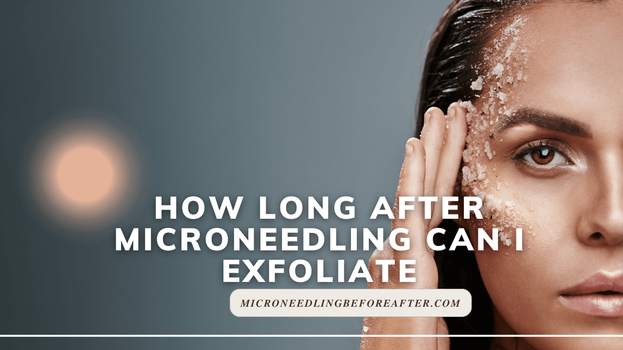 How Long After Microneedling Can I Exfoliate