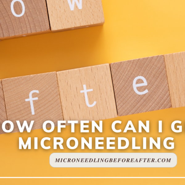 How Often Can I Get Microneedling