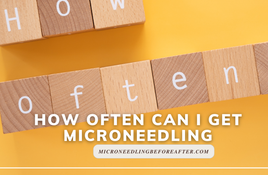 How Often Can I Get Microneedling