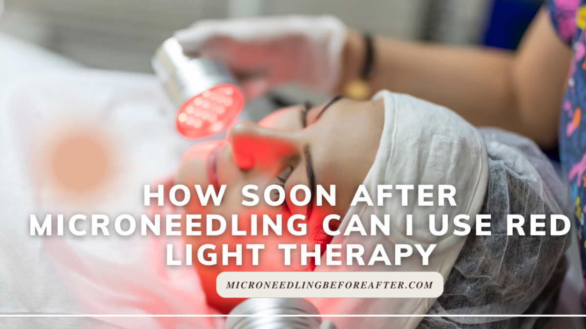 How Soon After Microneedling Can I Use Red Light Therapy