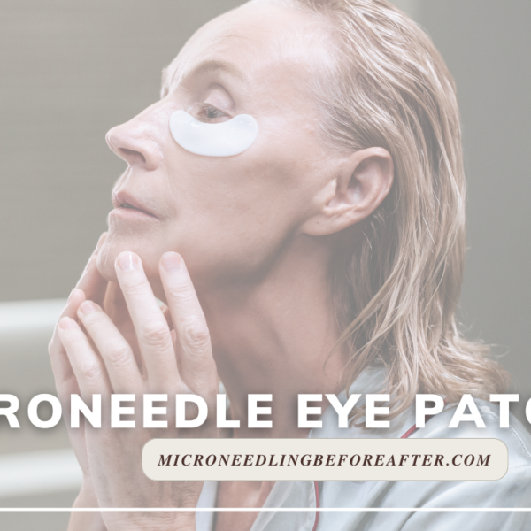 Microneedle Eye Patches