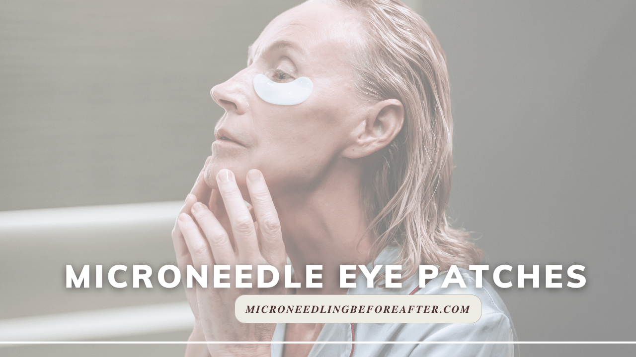 Microneedle Eye Patches