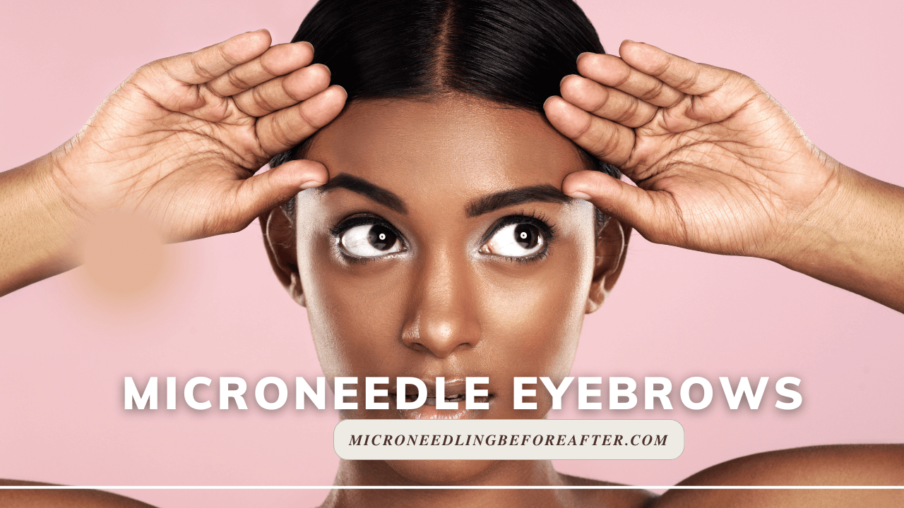 Microneedle Eyebrows