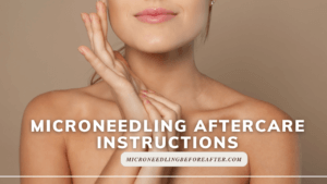 Microneedling Aftercare Instructions