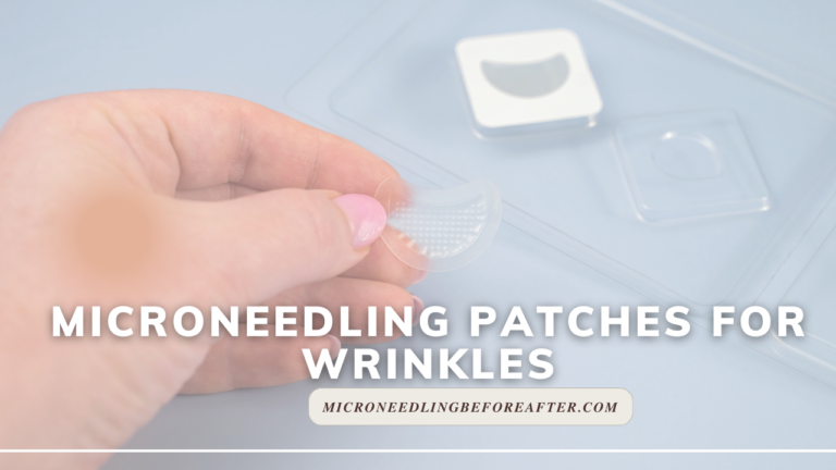 Microneedling Patches For Wrinkles