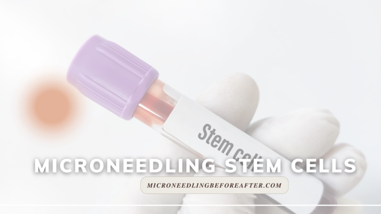 Microneedling Stem Cells