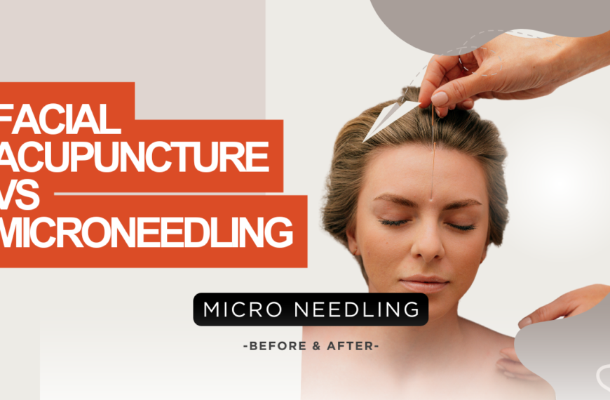 Facial Acupuncture Vs Microneedling