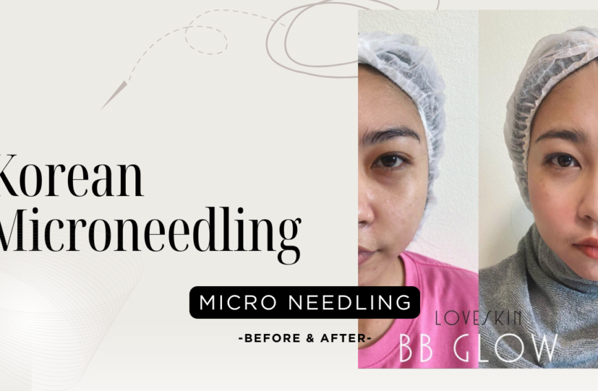 Korean Microneedling