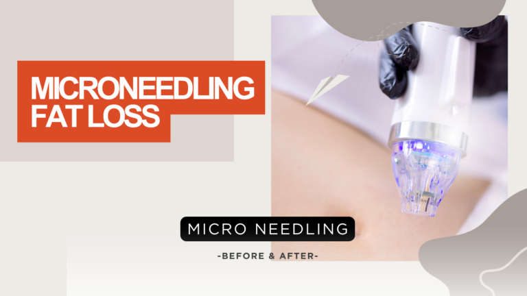 Microneedling Fat Loss