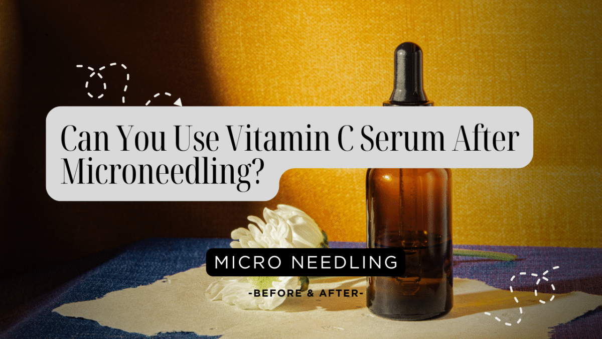 Can You Use Vitamin C Serum After Microneedling?