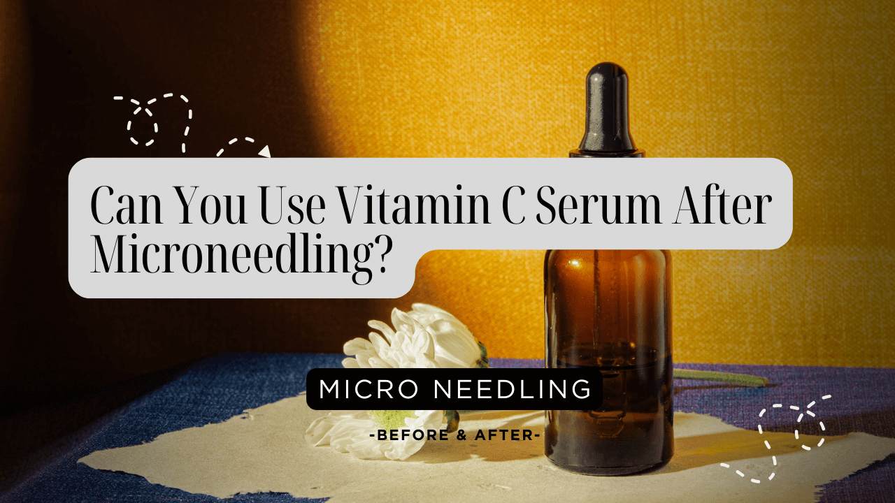 Can You Use Vitamin C Serum After Microneedling?