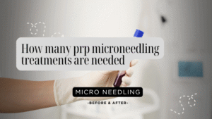 How many prp microneedling treatments are needed
