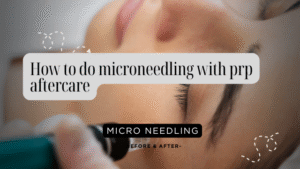 How to do microneedling with prp aftercare