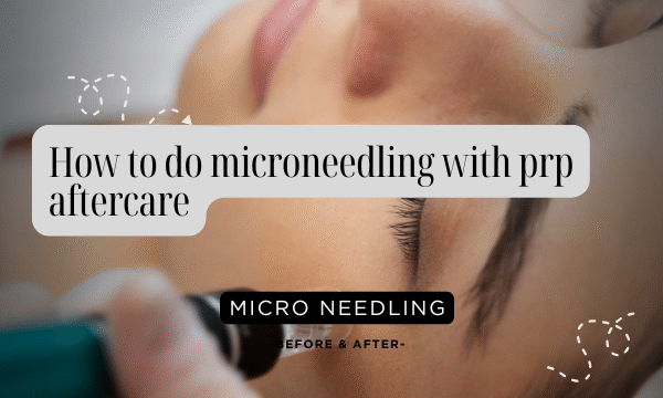 How to do microneedling with prp aftercare