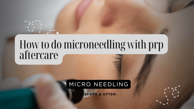 How to do microneedling with prp aftercare