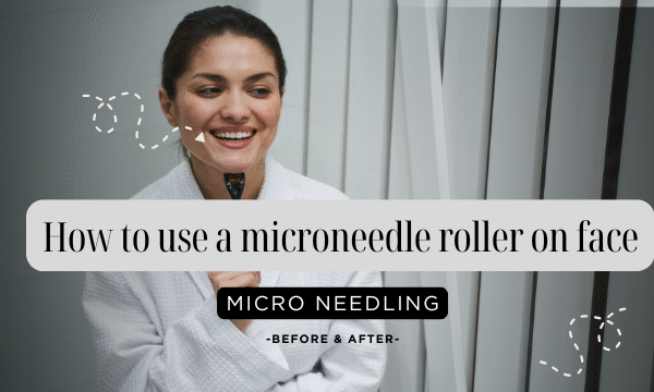 How to use a microneedle roller on face
