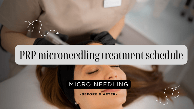 PRP microneedling treatment schedule