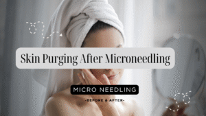 Skin Purging After Microneedling