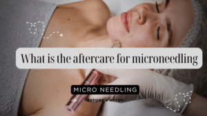 What is the aftercare for microneedling