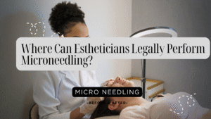 Where Can Estheticians Legally Perform Microneedling