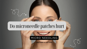 Do microneedle patches hurt