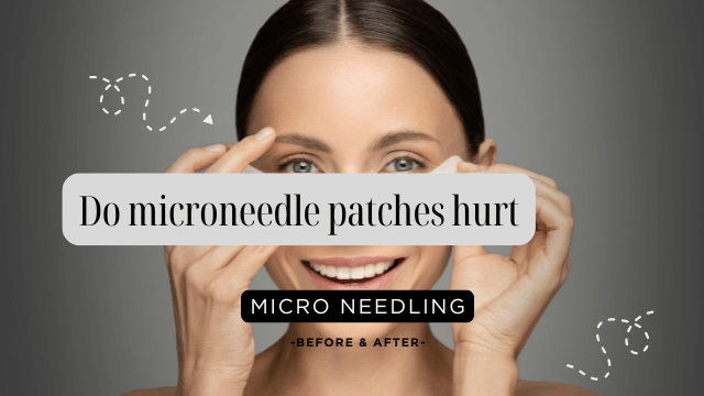 Do microneedle patches hurt?