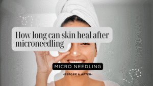 how long can skin heal after microneedling