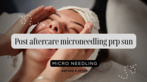 Sun Protection and Aftercare for PRP Microneedling
