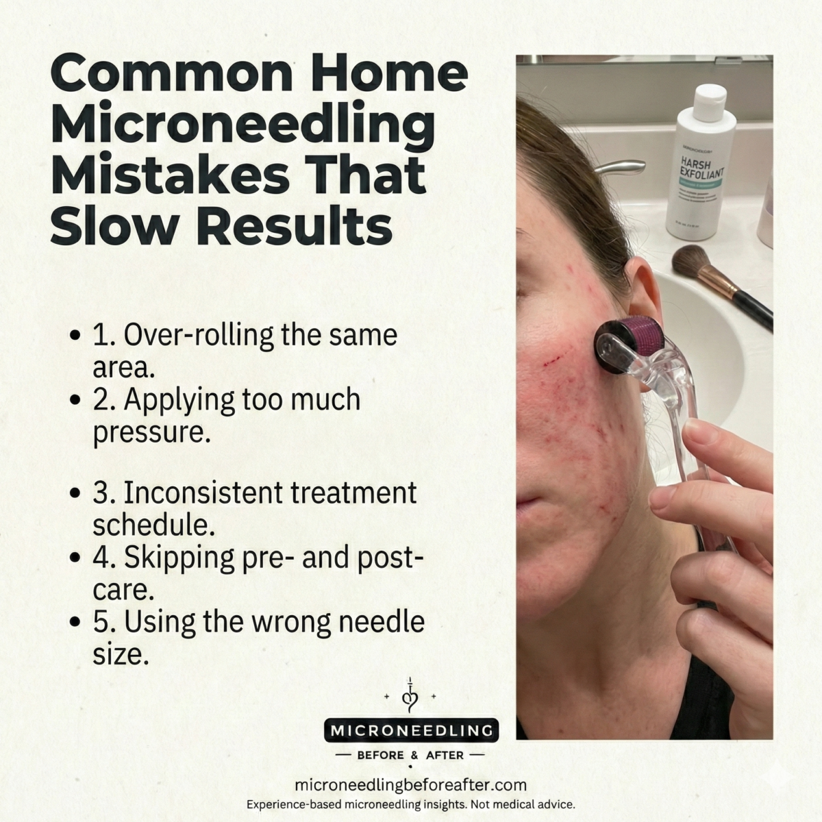 Common Home Microneedling Mistakes That Slow Results